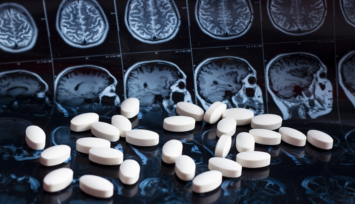 Avances esperanzadores contra el Alzheimer